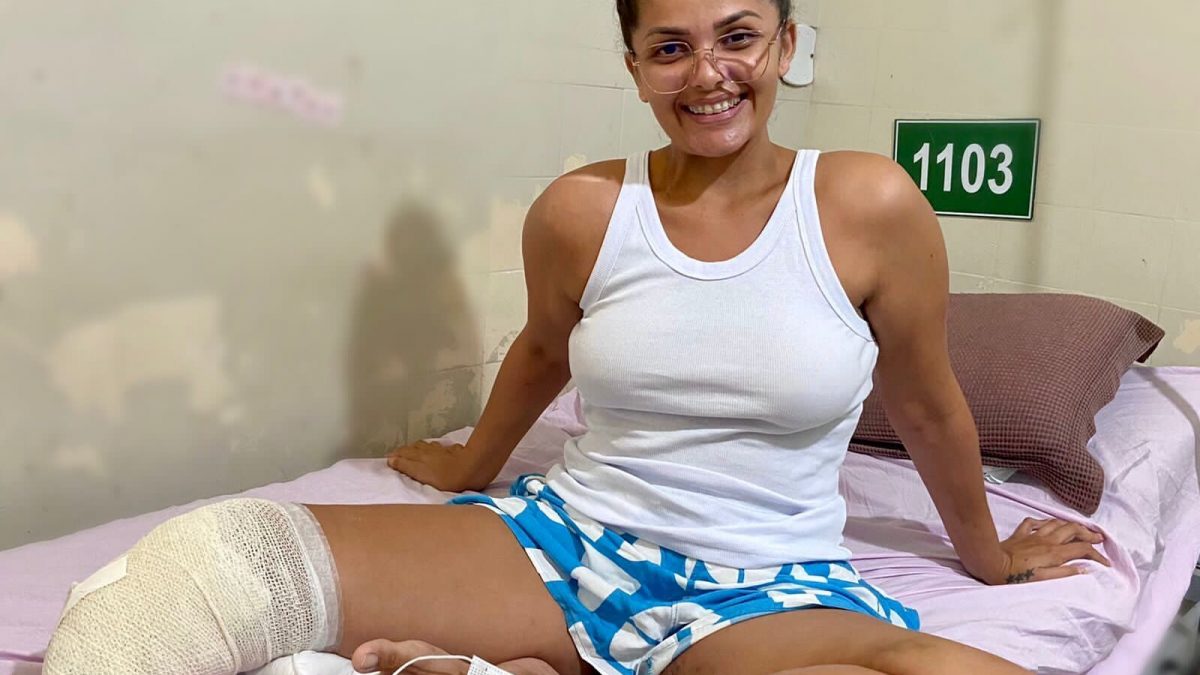 Após perder perna em acidente, jovem de Parnaíba pede ajuda para pagar prótese